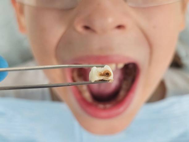 Best Pediatric Emergency Dentist in River Edge, NJ