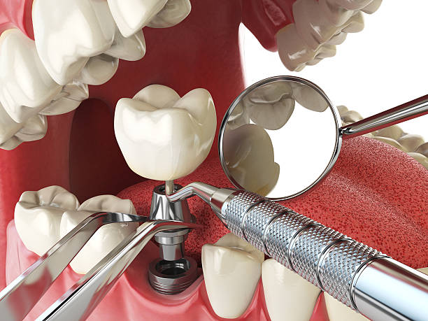 Best Emergency Dental Surgery in River Edge, NJ